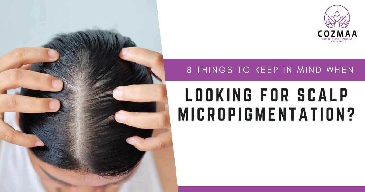 Do You Plan To Fill In Your Hairline With Scalp Micropigmentation (SMP)?