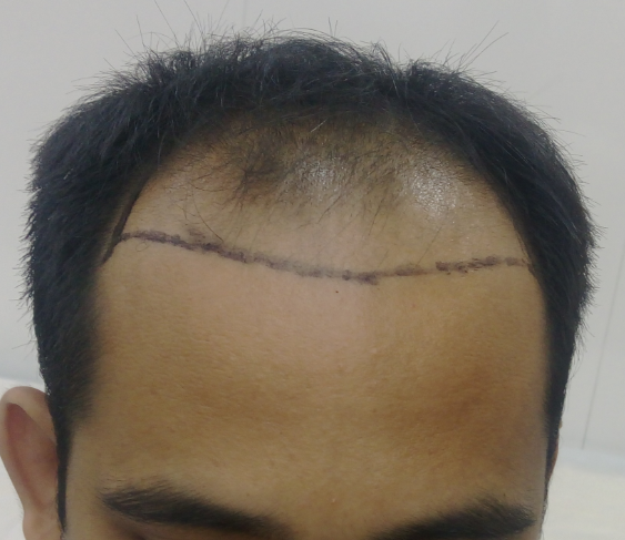 Before