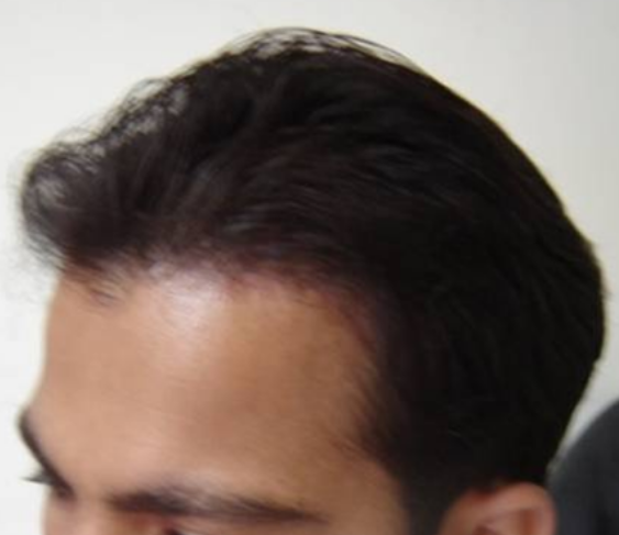 After