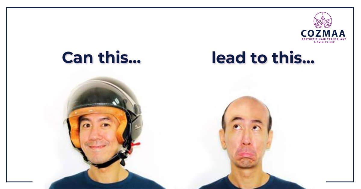 Does wearing a helmet causes hair loss?