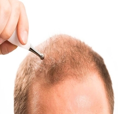 Hair Transplant  - Cozmaa