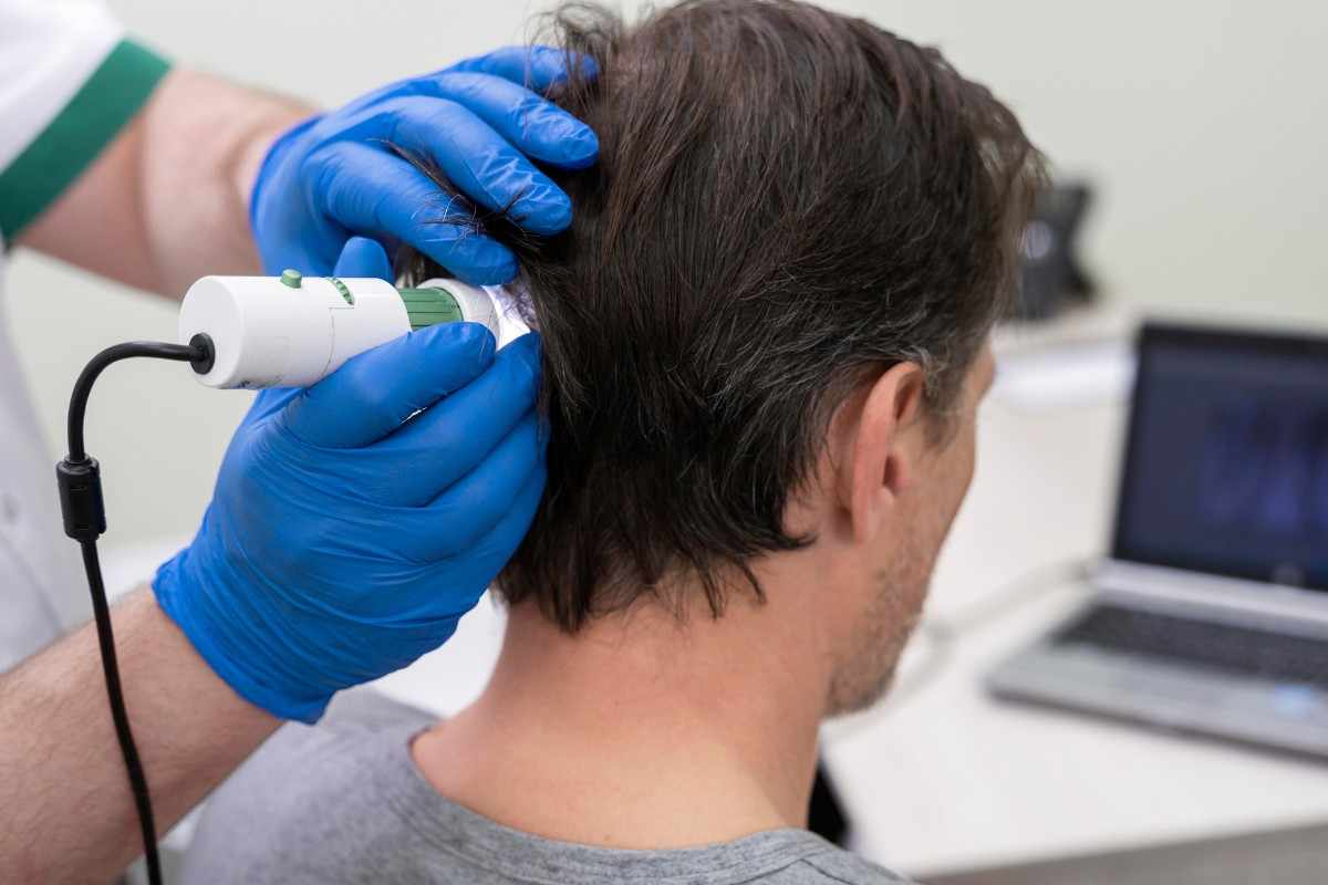 Hair Transplant  - Cozmaa