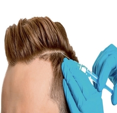 Hair Transplant  - Cozmaa 